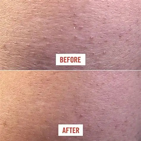 Verfrissende Exfoliatie Handschoen