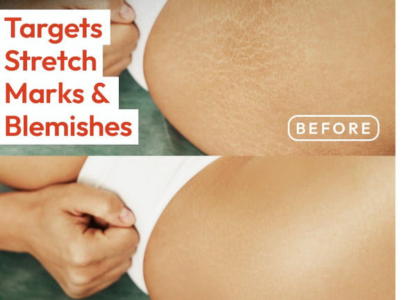 Magische Lichaamsolie Elixer