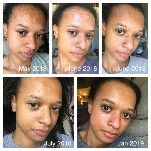 Afrikaanse Badnet Douche Scrubber