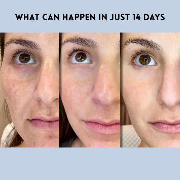 Auralift Renew Strips Voor Jongere Huid - VelvetRoots