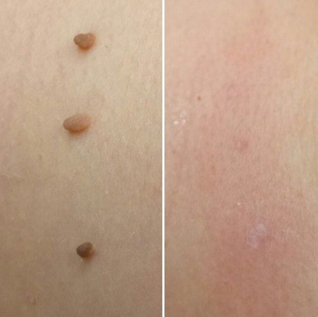 Auto Tag removal Kiit - VelvetRoots