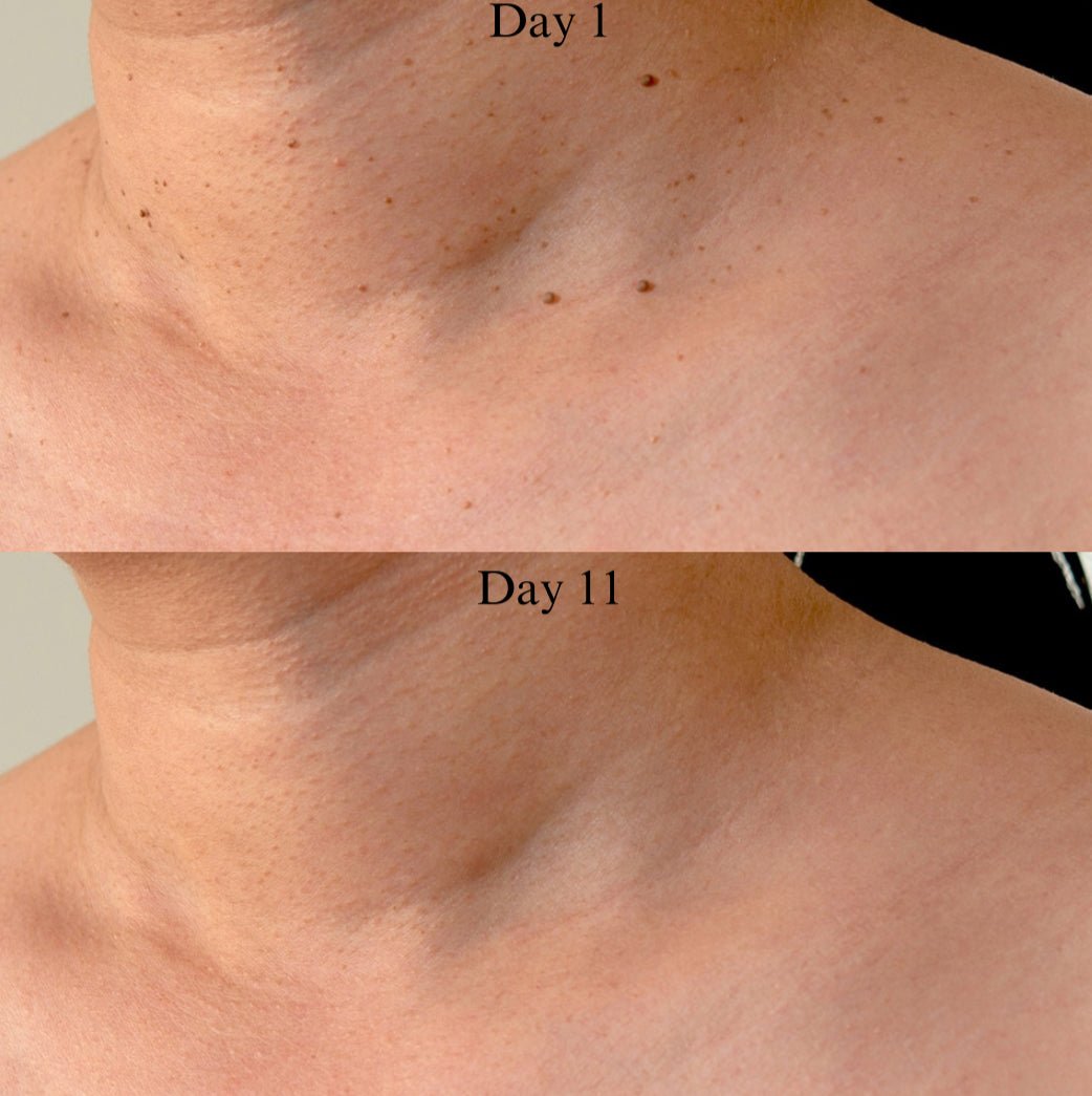 Auto Tag removal Kiit - VelvetRoots