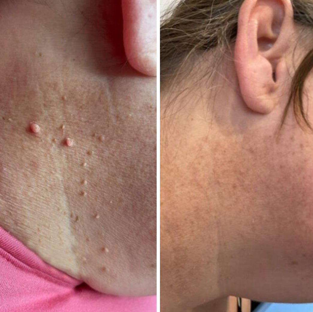 Auto Tag removal Kiit - VelvetRoots