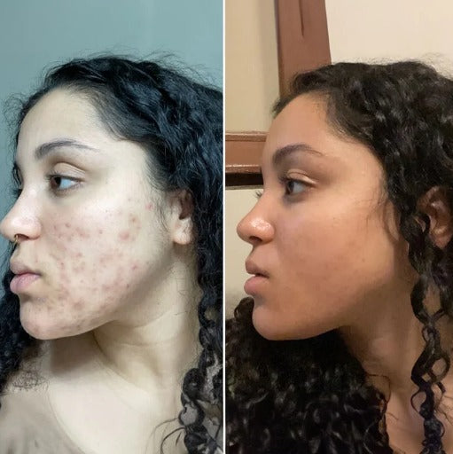 Stralende Huid Verzorgingspads