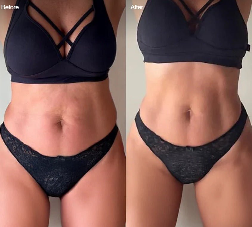 Elektrische Cellulite Massager - VelvetRoots