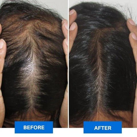 Elektrische Hoofdmassager voor Ontspanning - VelvetRoots