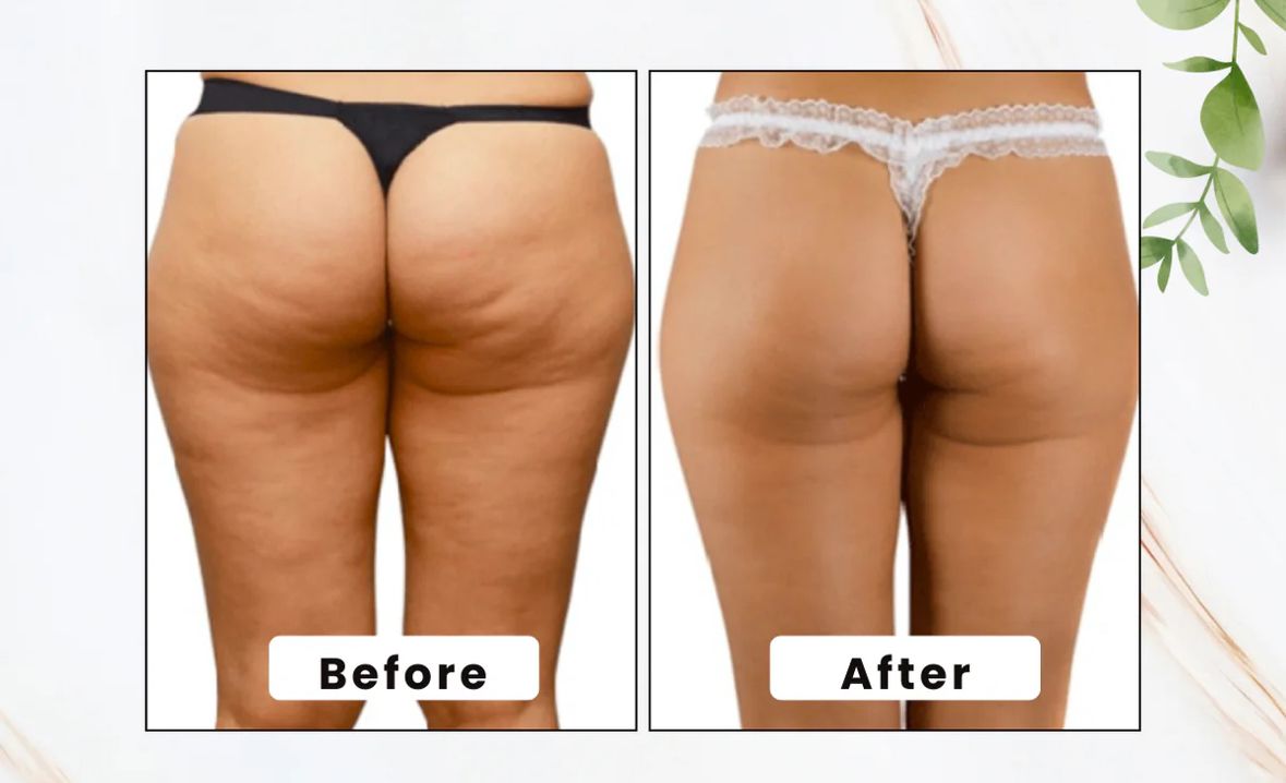 Gua Sha Massagehulpmiddel met Handvat - VelvetRoots