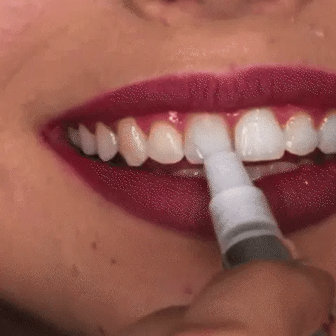 Brighten Snelle Witte Glimlach Gel