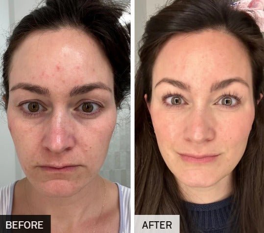 Lichttherapie Gezichtsmasker - VelvetRoots