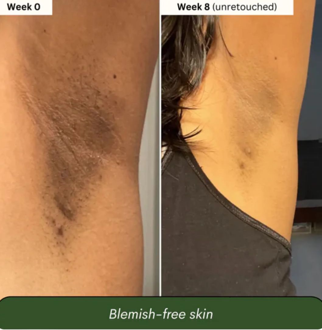 Stralende Huid Natuurlijke Zeep - VelvetRoots