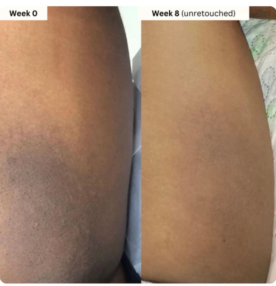 Stralende Huid Natuurlijke Zeep - VelvetRoots