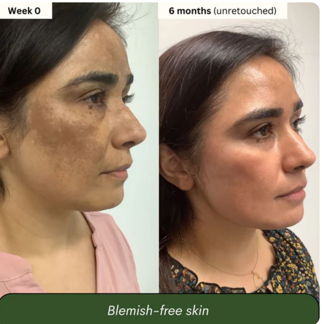 Stralende Huid Natuurlijke Zeep - VelvetRoots