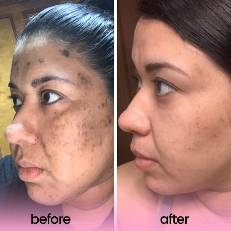 Stralende Huid Verzorgingspads - VelvetRoots