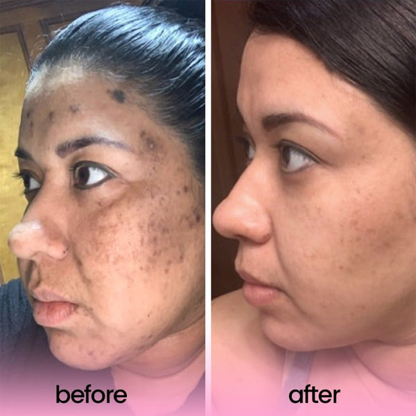 Stralende Huid Verzorgingspads