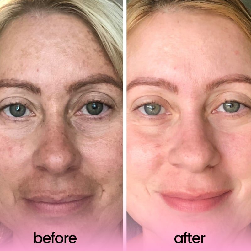 Stralende Huid Verzorgingspads - VelvetRoots