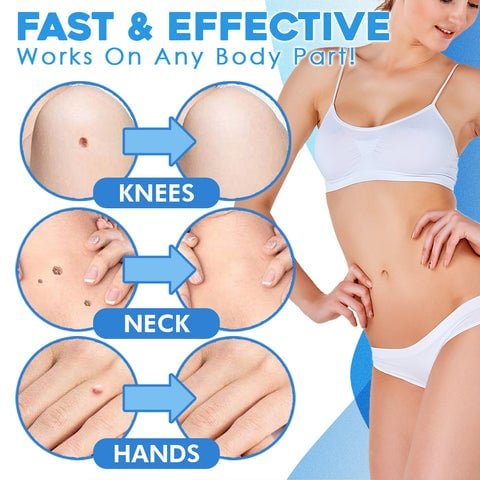 TagGone Huidtag Verwijderkit - VelvetRoots