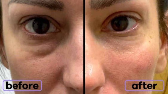 Verfrissende Oogmassage Apparaten - VelvetRoots