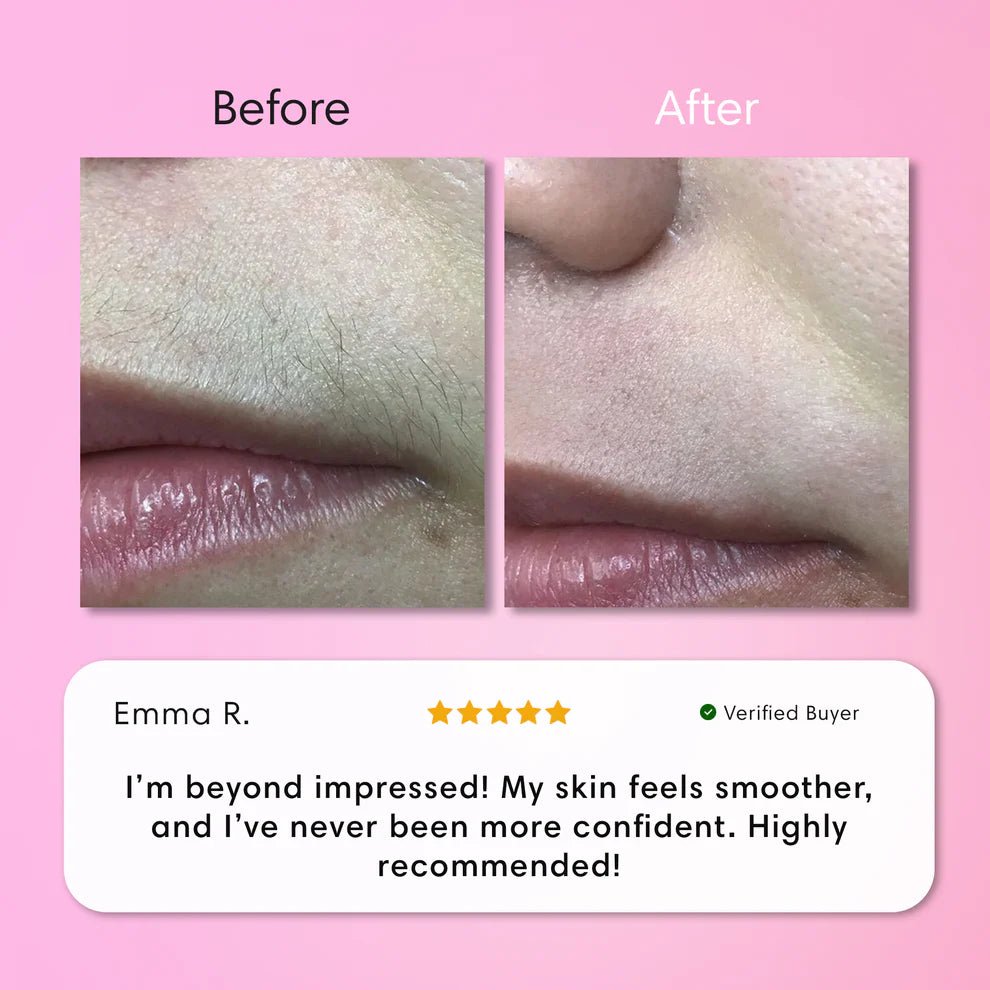 Zachte Ontharingscrème voor Lippen - VelvetRoots