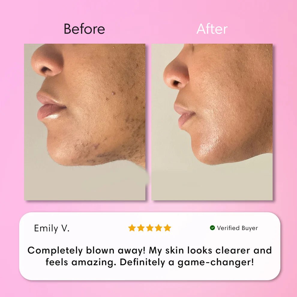 Zachte Ontharingscrème voor Lippen - VelvetRoots