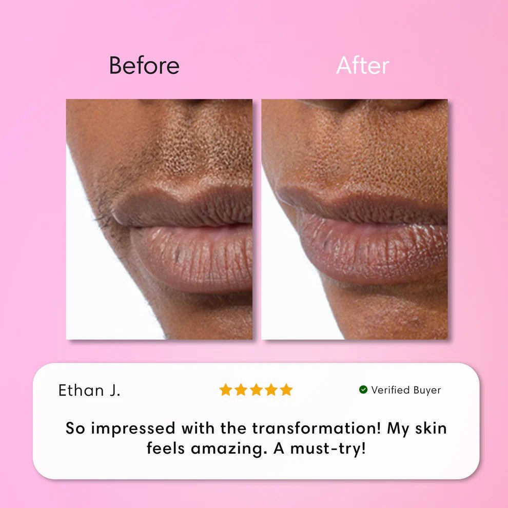 Zachte Ontharingscrème voor Lippen - VelvetRoots