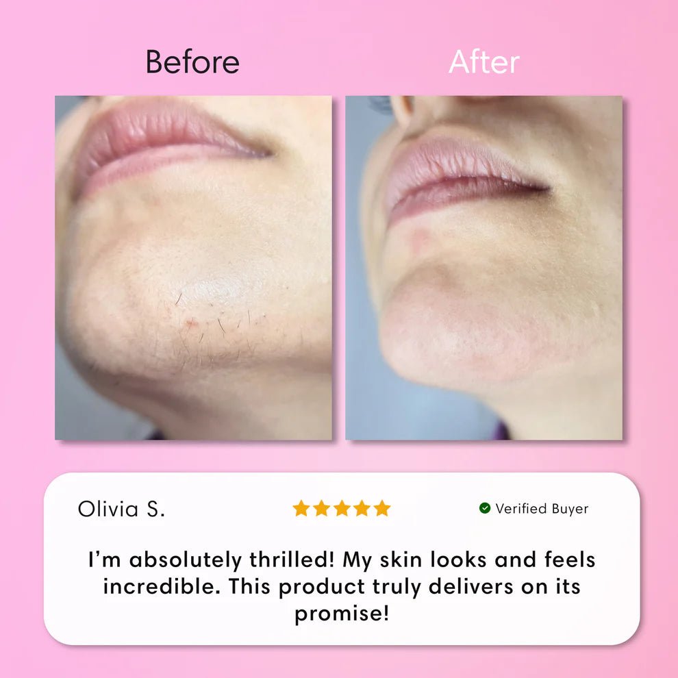 Zachte Ontharingscrème voor Lippen - VelvetRoots