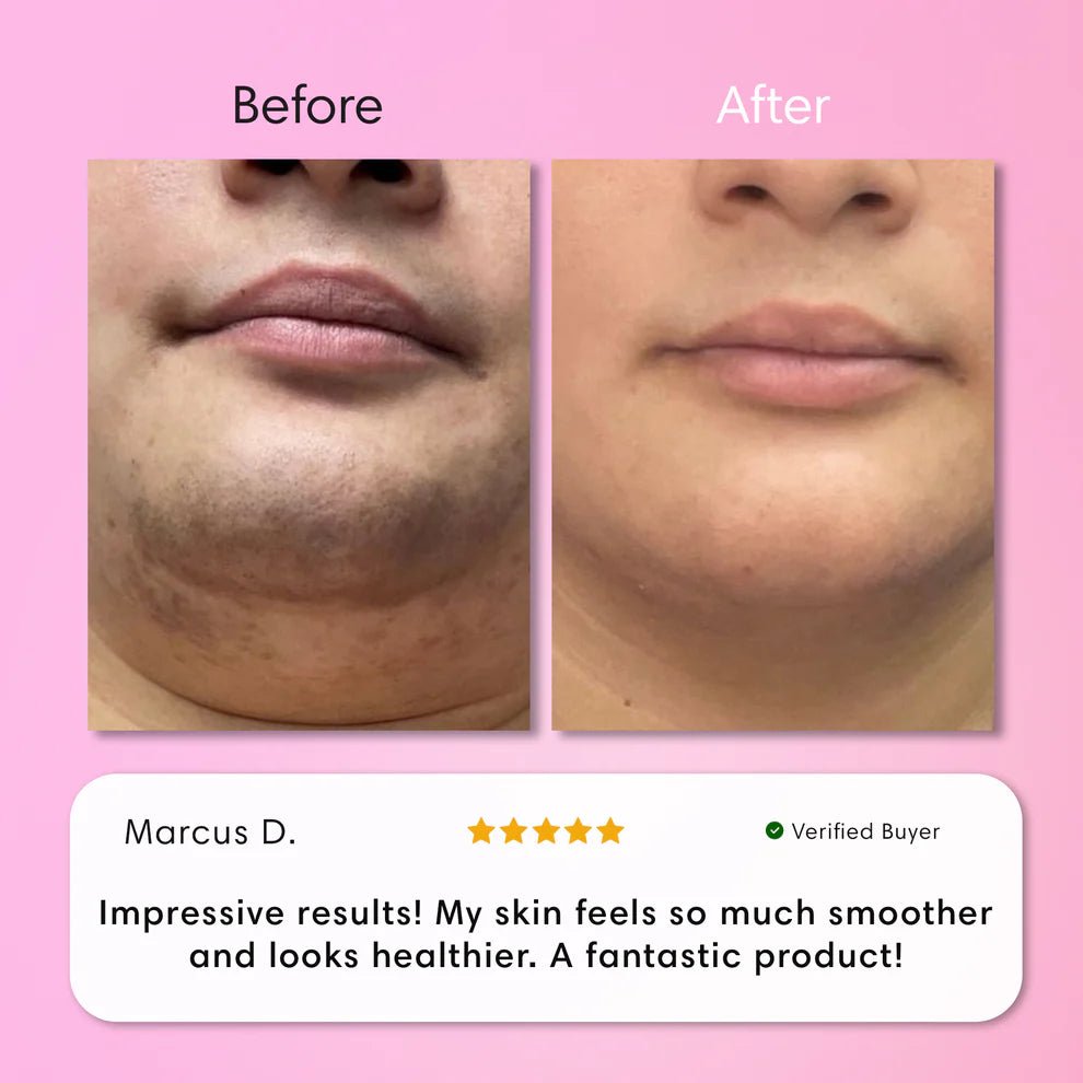 Zachte Ontharingscrème voor Lippen - VelvetRoots